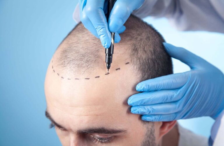 Natürliche Ergebnisse, vertrauenswürdige Expertise: thehairbank-berlin.de in Berlin