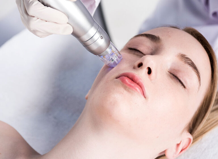 Microneedling Berlin Mitte: Effektive Hautpflege für ein Jüngeres Aussehen