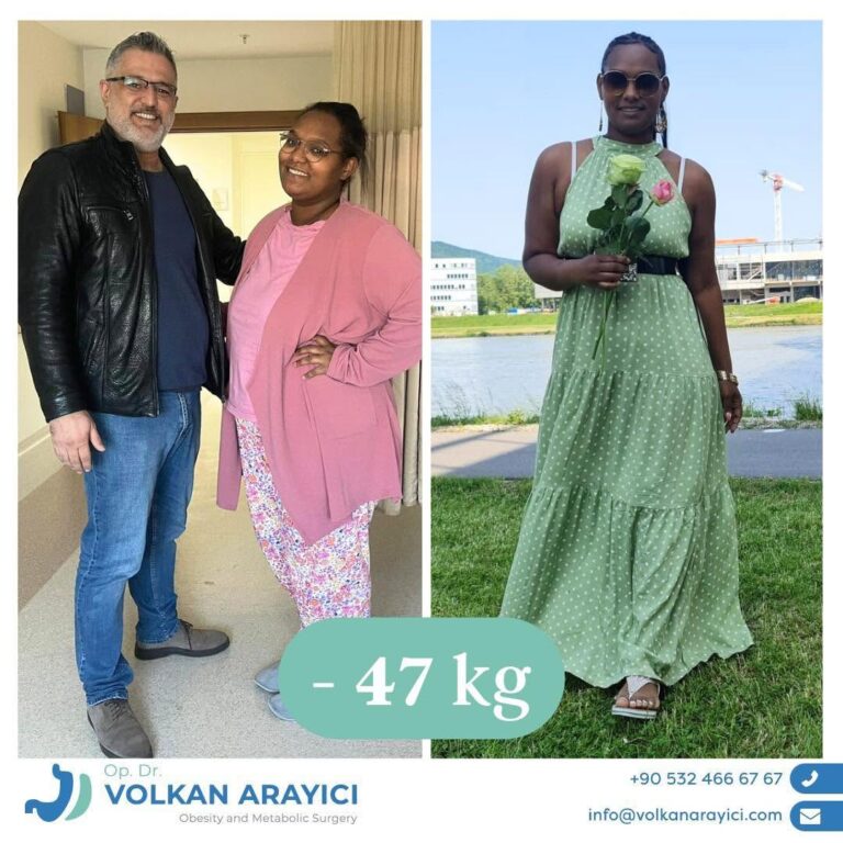 Gastric Sleeve Türkei: Aktuelle Preise und Angebote